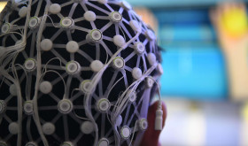 Person demonstrating a motor imagery brain-computer interface rehabilitation training system.